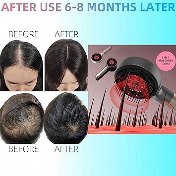 Therapy  Scalp Massage Comb